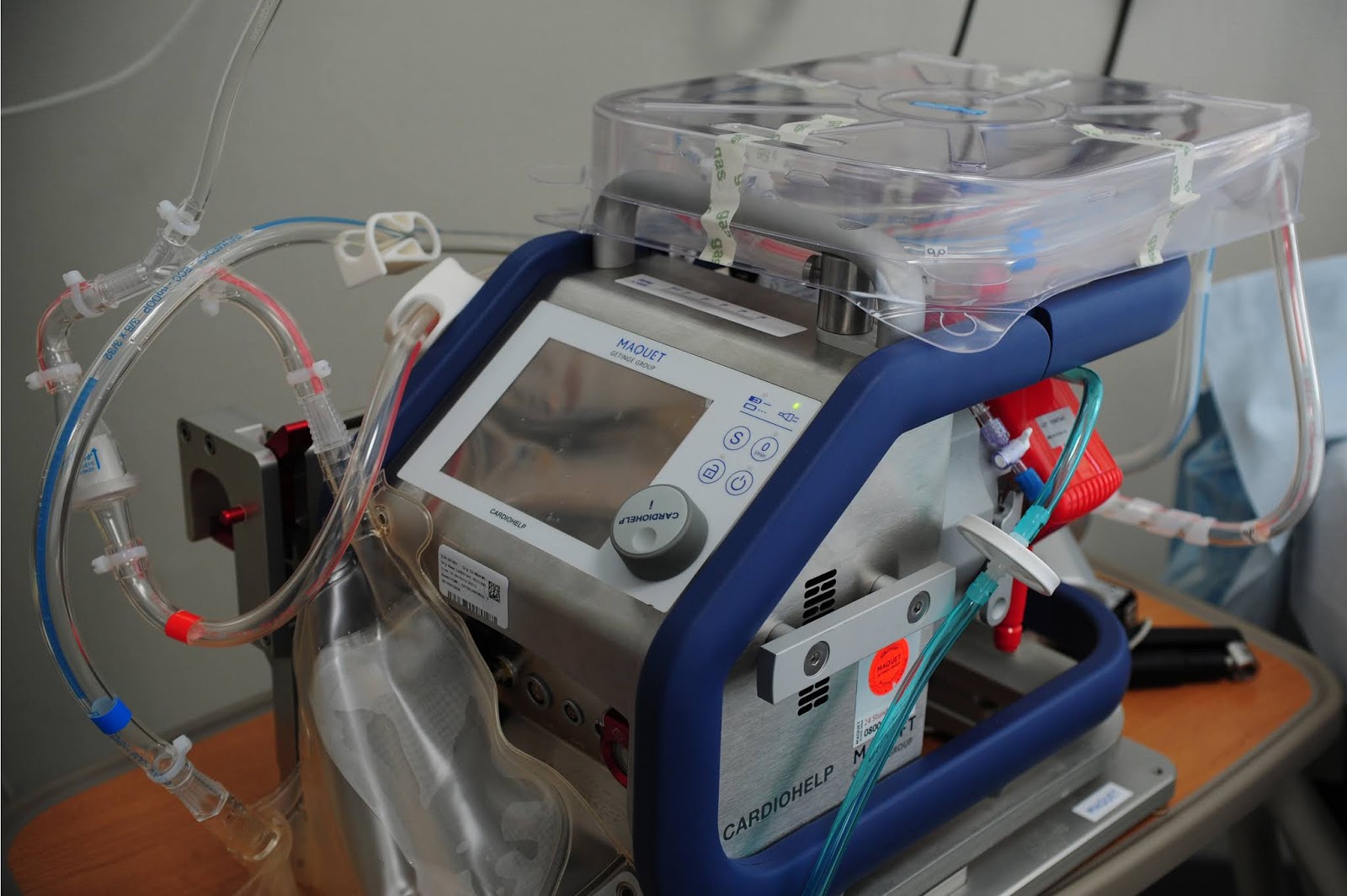 Пермская краевая больница закупает расходные материалы для единственного аппарата ЭКМО