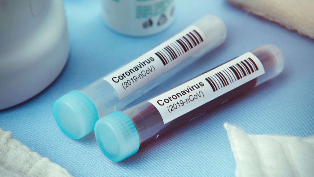 Экспресс-тесты на коронавирус могут появиться в Перми