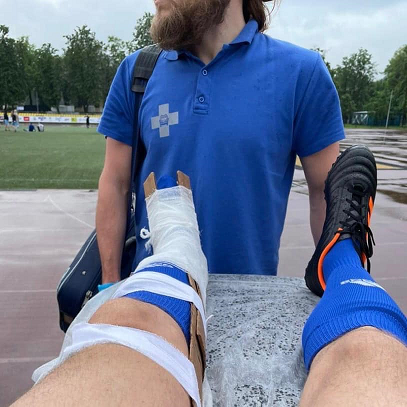 Врио спикера гордумы Перми Дмитрий Малютин сломал ногу на футбольном турнире